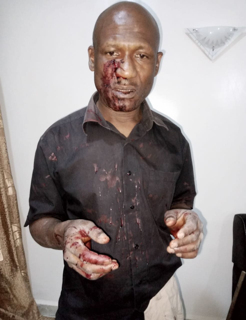 UNIDENTIFIED PERSONS ATTACKED, WOUNDED, FORMER GOVERNOR MATAWALLE’s CENSORSHIP BOARD CHAIRMAN, CHILDREN IN JOS.